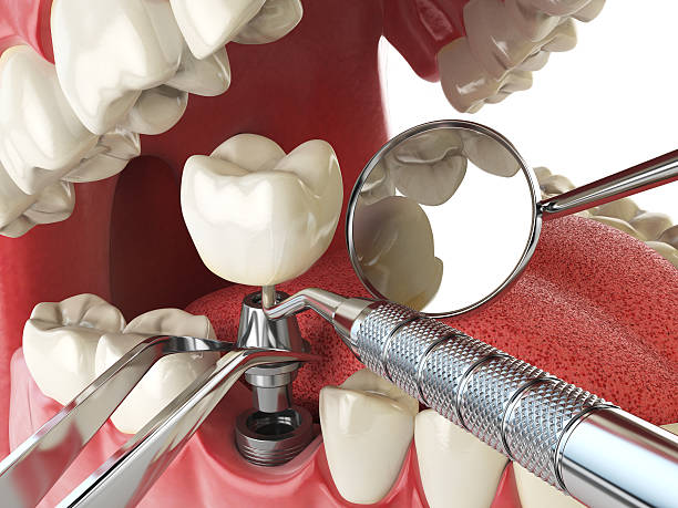 Best Dentist for Tooth Abscess  in Fort Leonard Wood, MO